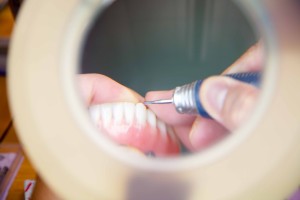 Dental Implant Toronto